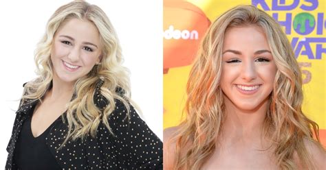 chloe lukasiak eye problems.